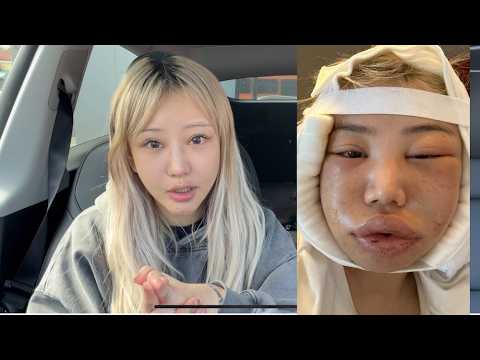 I Spent Over 100K on plastic surgeries, so you don't have to (seriously don't) — mealtime video thumbnail